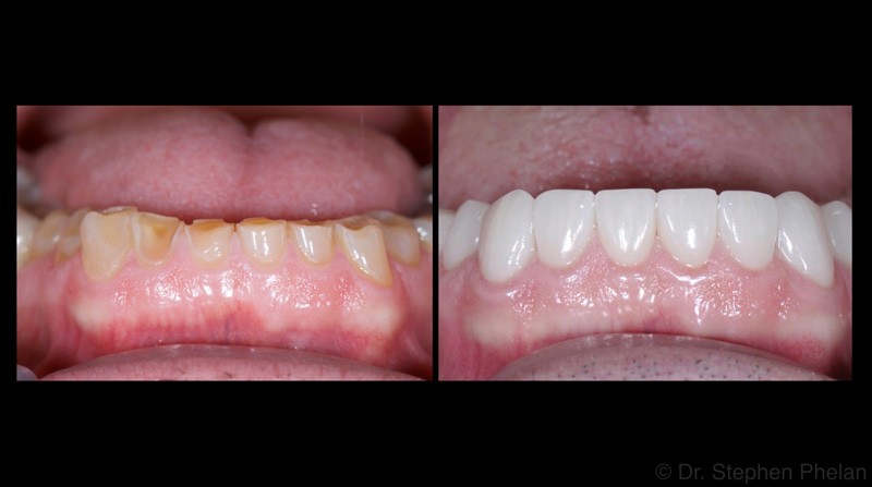 Before and After Cosmetic Treatment