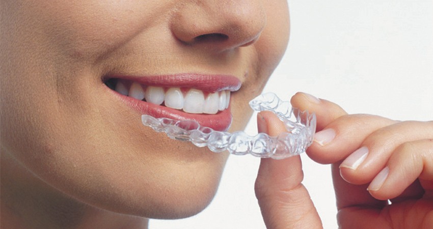 A Woman Holding Clear Aligners